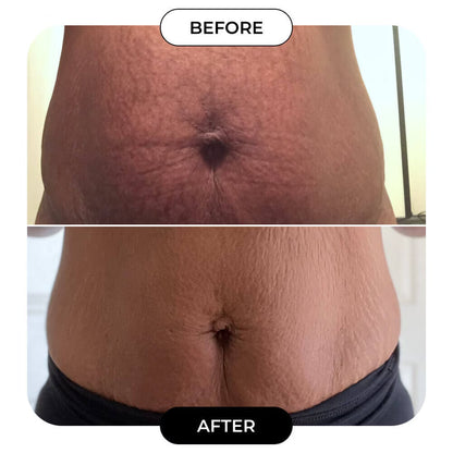 B-Flat Belly Firming Cream!