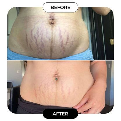 B-Flat Belly Firming Cream!