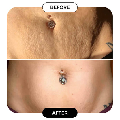 B-Flat Belly Firming Cream!
