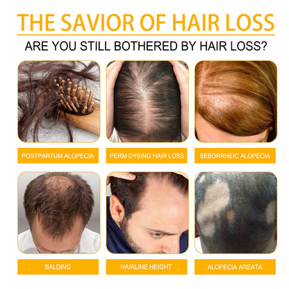 Ginger Hair Fast Growth Serum Spray Biotin, Anti Hair Loss