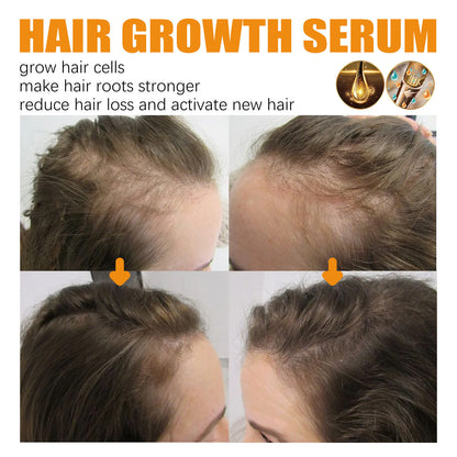 Ginger Hair Fast Growth Serum Spray Biotin, Anti Hair Loss
