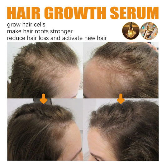 Ginger Hair Fast Growth Serum Spray Biotin, Anti Hair Loss